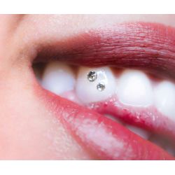 Formation Blanchiment Dentaire & Strass