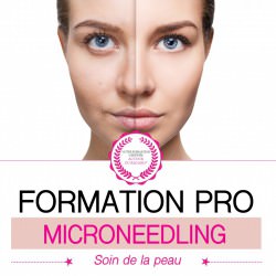 Formation Microneedling